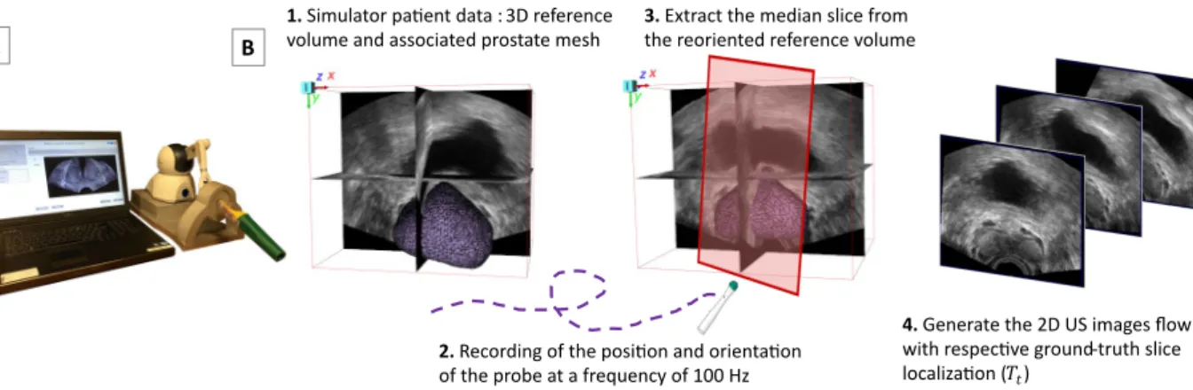Figure 2. Data generation process. A) Biopsym Simulator. B) Generation of the 2D US image flow from a clinical reference volume, associated with a realistic biopsy trajectory.