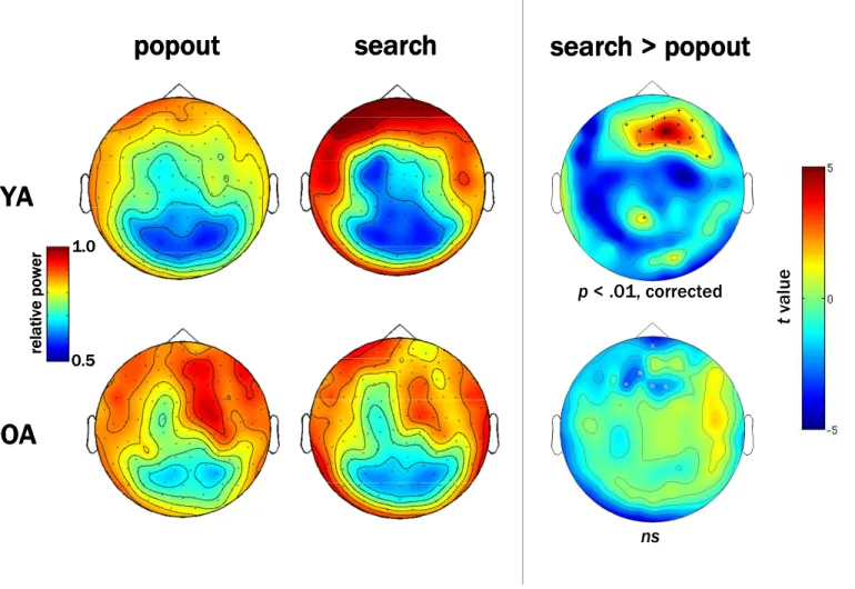 Figure 4. Topographic plots of sensor-level beta band activity during popout (left) and effortful (middle) search trials from 200-800  ms