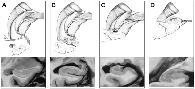 Figure 2.9: Coronal sections of hippocampus, and 3D diagrams, showing planes of section.