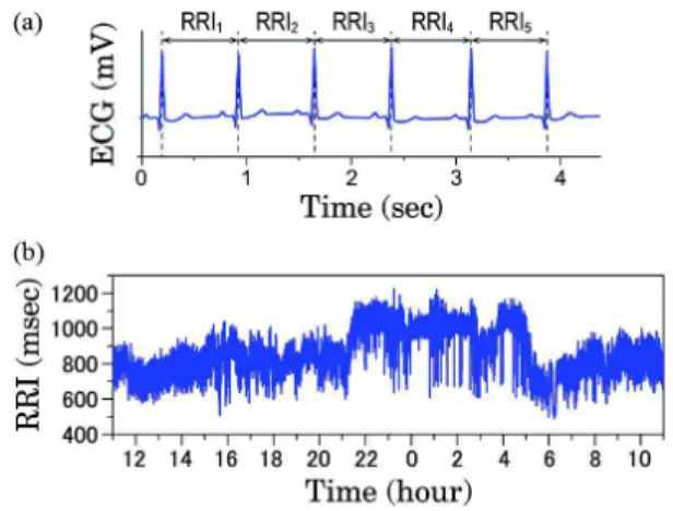 Fig. 2. Definition of R-R interval (RRI) and 24 hour heart rate variability (HRV). In general HRV analysis, the R-peak in normal sinus rhythm is assumed