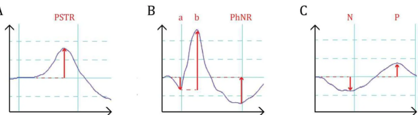 Figure  12. ERG  and  VEP  traces. A)  Scotopic  ERG  with  a  representative PSTR-wave