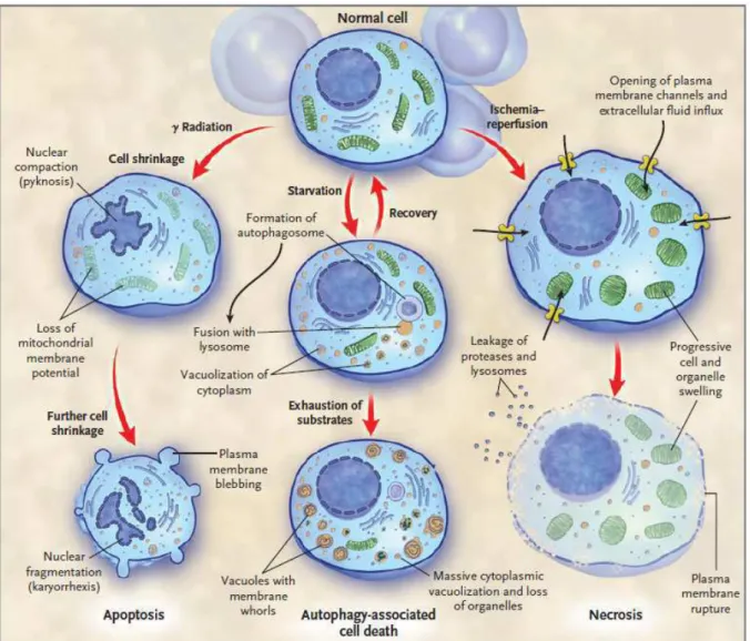 Figure 1 : Les trois principaux types de mort cellulaire : apoptose, autophagie et nécrose
