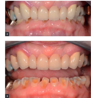 fig. 1 - Photographie de face de la patiente