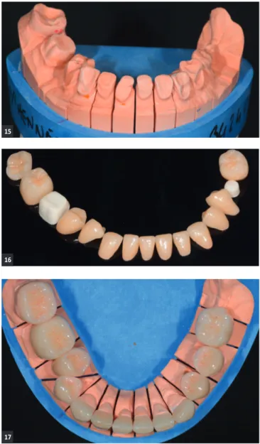 fig. 14 - Choix de la teinte.