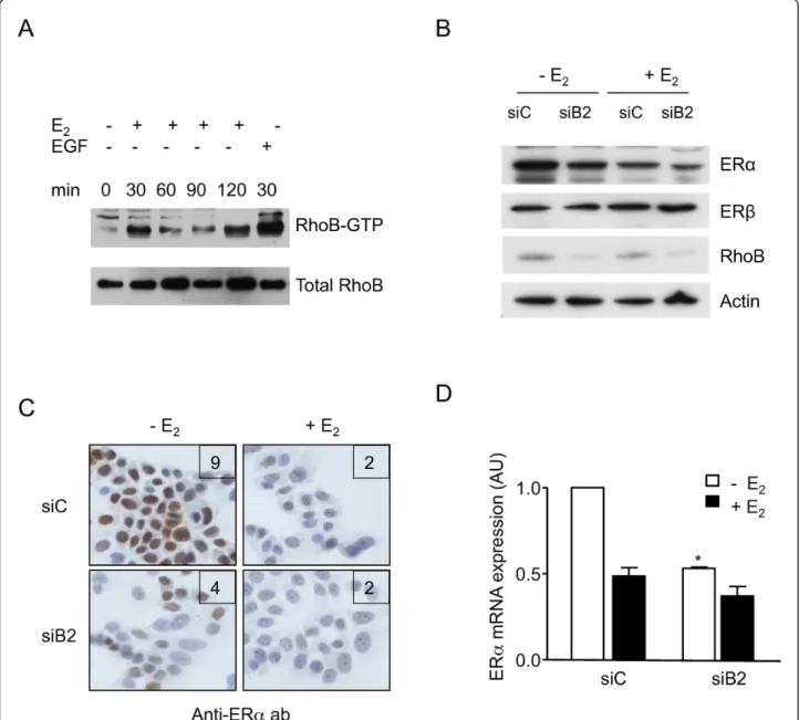 Figure 3 RhoB activation and regulation of estrogen receptor alpha expression with/without estradiol in MCF-7 cells