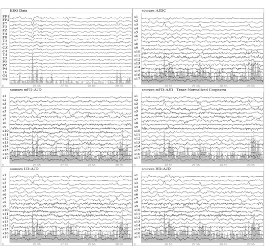 Fig. 3: 5 last seconds of the original EEG data and the 17 sources obtained with classical algorithm AJDC [15], mFD-AJD, mFD-AJD with trace-normalized cospectra, LD-AJD and RD-AJD