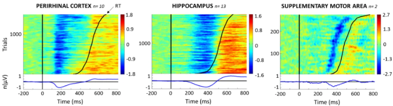 Figure 4 – ERP images. Upper panel: single-trial ERP collapsed across subjects  and ordered by reaction times (black continuous curve)