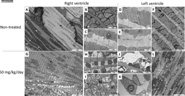Figure 2. Transmission electron micrograph of non-treated (A–F) and 50 mg I-BET-151/kg/day treated  (G–L) mouse right ventricle (A–C,G–I) and left ventricle (D–F,J–L)