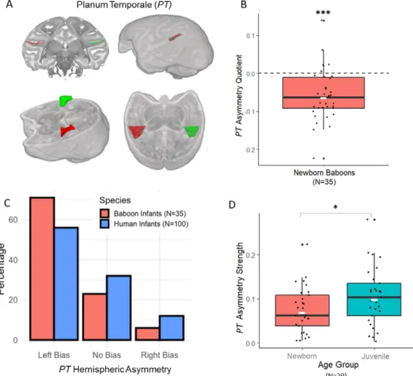 Fig. 1. (A) Representation of the asymmetric Planum Temporale ( PT ) in the baboon brain on a T2w image according to a coronal section, 3D brain render and oblique section oriented along the Sylvian Fissure (the left PT is in red and the right PT in green)