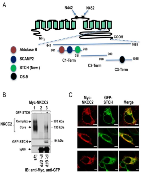 Figure 1. Identification of STCH as a novel NKCC2-interacting protein. (A) Mouse NKCC2 yeast two- two-hybrid baits constructs