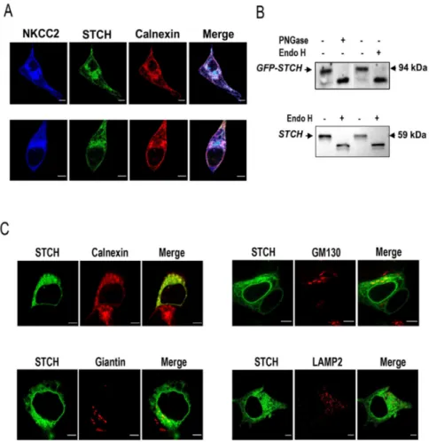Figure 2. STCH co-localizes with NKCC2 mainly at the Endoplasmic Reticulum. (A) Intracellular localization of NKCC2 and STCH in HEK cells