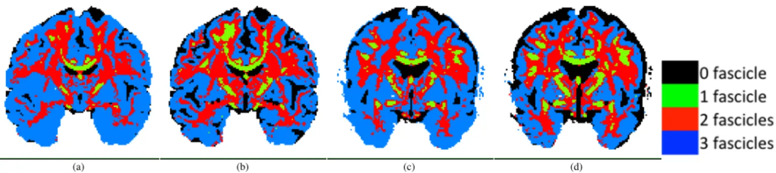 Figure 1 shows a coronal view of these maps for subject #1 (a,b) and #2 (c,d) assuming Gaussian (a,c) and NCC (b,d) noise