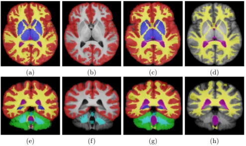 Fig. 1. Database of Segmentations. Individual manual segmentations registered on an average image