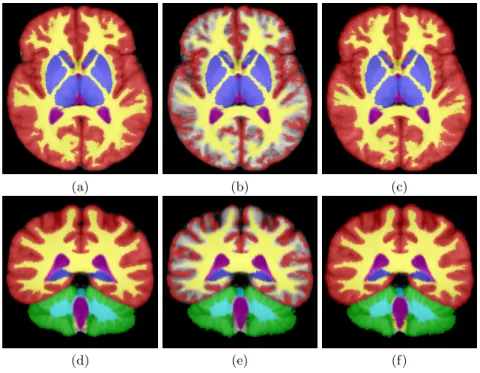 Fig. 2. Results on Label Fusion with Missing Data. (a,d): reference label fusion (all structures used), (b,e): label fusion with a third of the segmentations, (c,f): label fusion with a third of the segmentations with prior information.