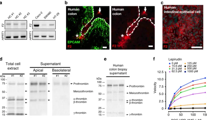 Fig. 1 Intestinal epithelium releases active thrombin in gut lumen. a F2 mRNA transcripts (Factor 2, thrombin) were detected in colonic crypt epithelium from three different healthy human (left), and three different human cancer cell lines (Caco-2, SW480 a