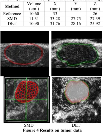 Tab. 2 Quantitative comparison with phantom image  Method  Volume  (cm 3 )  X   (mm)  Y  (mm)  Z  (mm)  Reference 10.60  33  -  26  SMD 11.31 33.28 27.75  27.39  DET 10.90 31.76 28.16  25.92     SMD    DET   