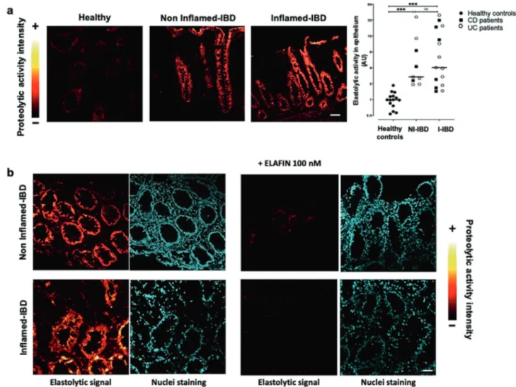 Fig. 1 Elastolytic activity is increased in epithelial cells from IBD colonic biopsies