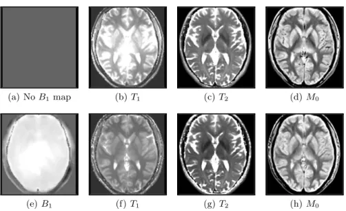 Fig. 2. Estimated maps on one healthy subject. Row 1 shows the maps using the regular method, row 2 using the proposed method