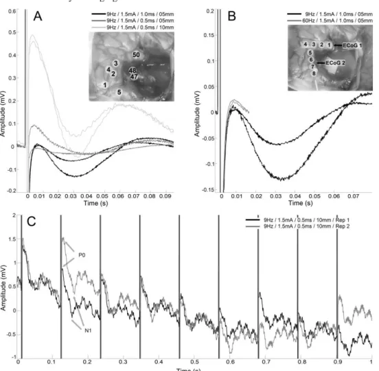 Figure 1.   A: Mean DCR over 50 stimuli for the 3 conditions at 9 Hz (each condition was repeated twice), recorded between electrodes 2 and 3