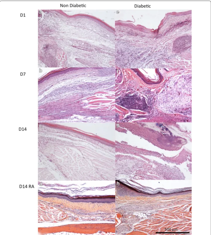 Figure 4  Histology of mouse hindpaws. The effect of levobupivacaine and sufentanil were tested on histopathology of diabetic and non‑diabetic  mouse hind paws at different days postsurgery: a non‑diabetic mice 1 day (D1) after skin incision showing acute 