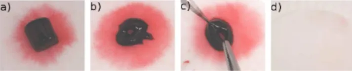Fig. 7: Quelques exemples de caillots apr` es insoniﬁcation dans du plasma sanguin : a) caillot intact