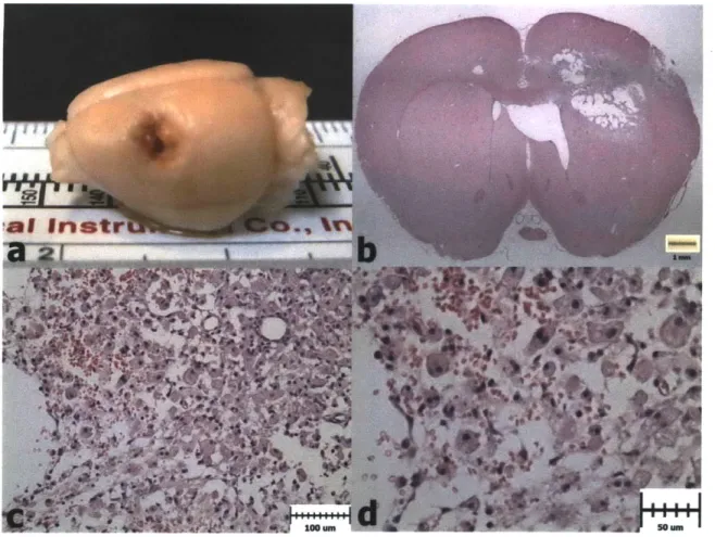 Figure 3.6.  H&amp;E Histology  1 Week  after  PBI (Group  1).  a)  PBI lesion  evident  in the extracted  brain from a  Group  1 animal