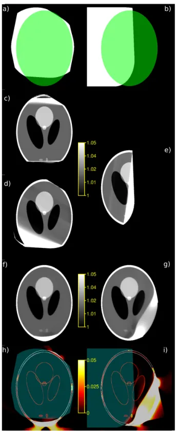 Fig. 3. Reconstructions of simulated cases motion 1 (first column) and motion 2 (second column) with the iterative reconstruction method