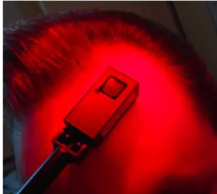 Figure 1. Irradiance measurement with the PD300 photodiode sensor. 