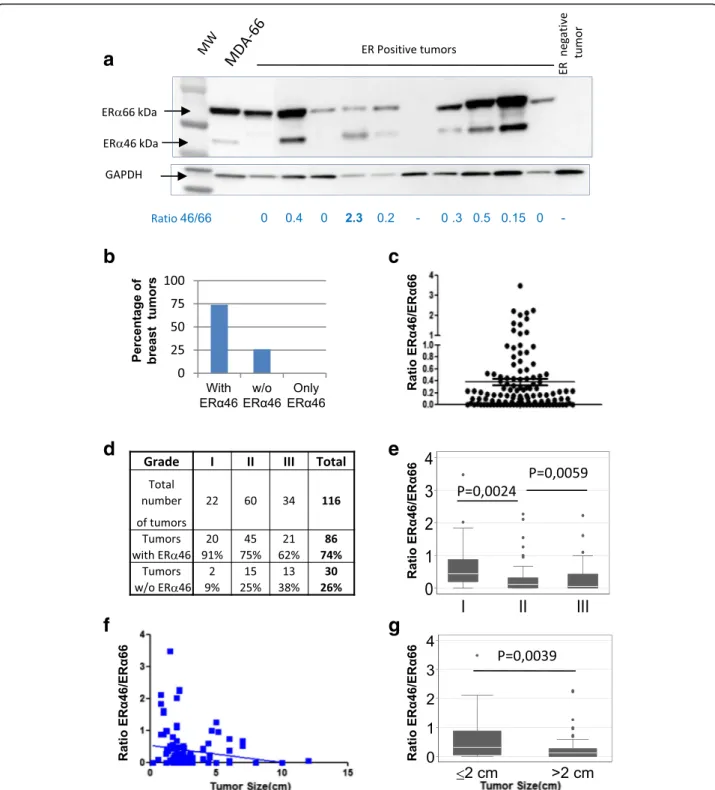 Fig. 2 Evaluation of the relative expression of estrogen receptor alpha (ER α )46 and ER α 66 in human ER α -positive breast tumors