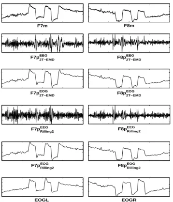 Fig. 5. Comparison between the bivariate 2T-EMD approach and Rilling2 in the context of EOG artifacts removing from EEG.