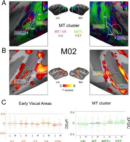 Figure 6: A) Retinotopic mapping of the Superior Temporal Sulcus (STS) for M02 and  delimitation of the MT cluster areas: MT (dark blue), V4t (pink), MSTv (orange), and FST  (green)