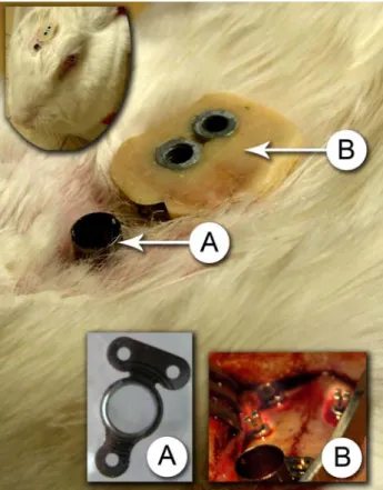 Figure 18: Chambre optique implantée (A) et dispositif de repositionnement (B)  L’ensemble du dispositif est bien intégré, aucune réaction inflammatoire ou de rejet n’a été  observée