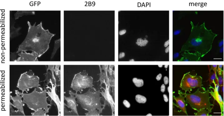 Fig 5. 2B9 binds to the intracellular domain of S1P 1 . CHO S1P 1 -GFP cells were seeded on coverslips and fixed 24h later