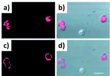 Figure 9 : Images  obtenues  en  microscopie  confocal  à  balayage  laser  en  réflexion  (a,c)  et  en  combinant  réflexion  et  transmission  (b,d)  de  cellules  marquées  par  des  nanoparticules  d’or/anti-EGFR  (protéine  surexprimée  par  les  cel