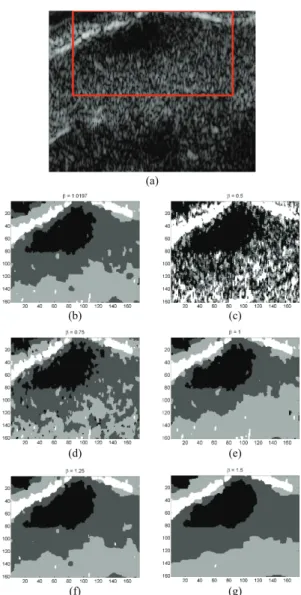 Fig. 5. (a) Multilook SAR image. (b) Optical image corresponding to (a), MAP labels when (c) β is estimated and (d) for β = 1.
