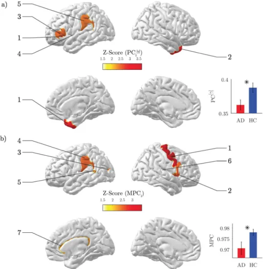 Figure 3.  Network analysis of brain connectivity. (a) Inter-modular centrality. Statistical brain maps of group  differences for local participation coefficients PC i  in the gamma band