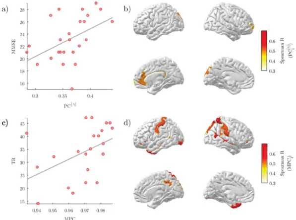 Figure 6.  Correlation between brain network properties and cognitive/memory scores. (a) Scatter plot of the  global participation coefficient in the gamma band (PC [γ] ) and the mini-mental state examination (MMSE)  score of AD subjects (Spearman’s correl