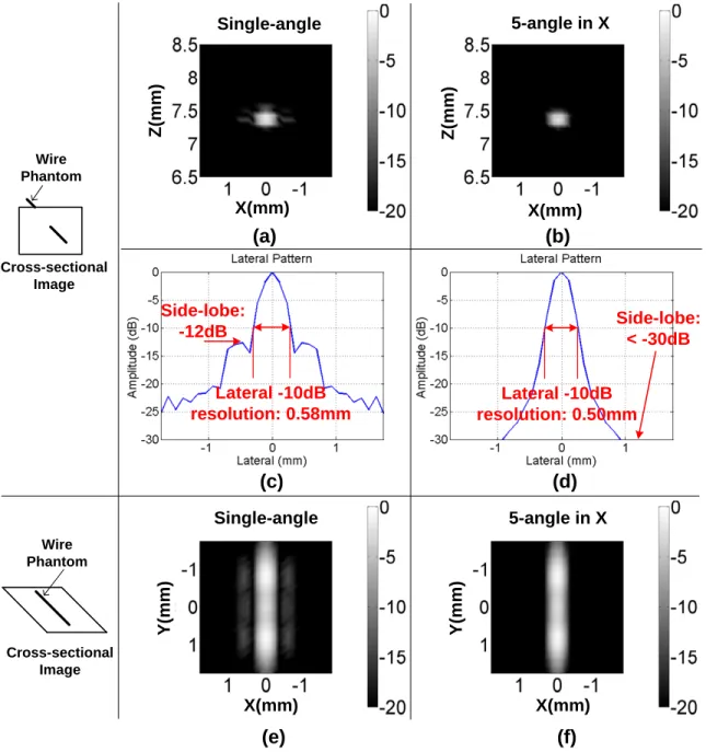 Figure 4-20: Simulation results of a wire phantom: (a) vertical cross-sectional im- im-age produced from single angle plane-wave insonification; (b) vertical cross-sectional image produced from 5-angle coherent compounded plane-wave insonification; (c)  la