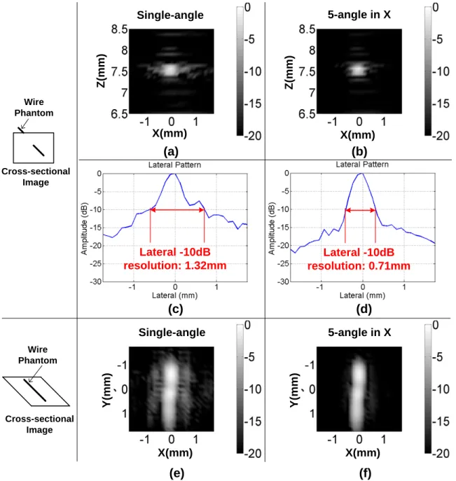 Figure 4-21: Measurement results of a wire phantom: (a) vertical cross-sectional im- im-age produced from single angle plane-wave insonification; (b) vertical cross-sectional image produced from 5-angle coherent compounded plane-wave insonification; (c)  l