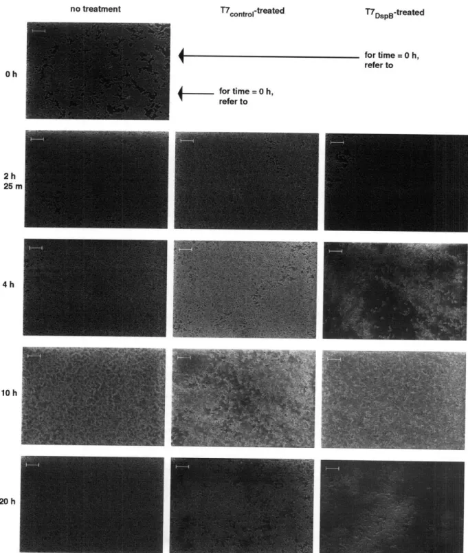 Figure 5.  Scanning  electron  microscopy images  for untreated, T7conol 1 -treated, and  T7DspB-treated  biofilms