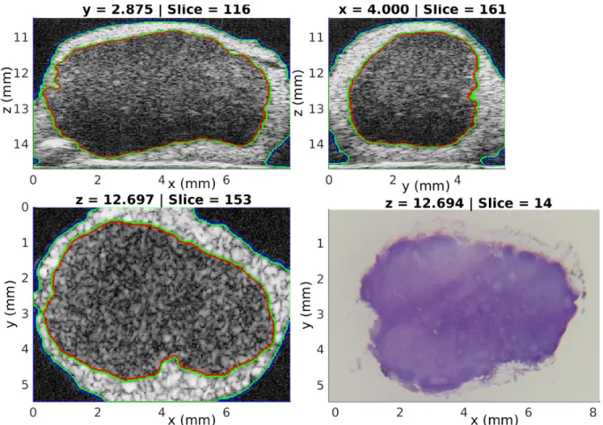 Figure 2.2: Three orthogonal cross-sectional views showing the segmentation of three regions overlaid on B-mode data (40-dB dynamic range) acquired from a non metastatic LN of a colorectal cancer patient