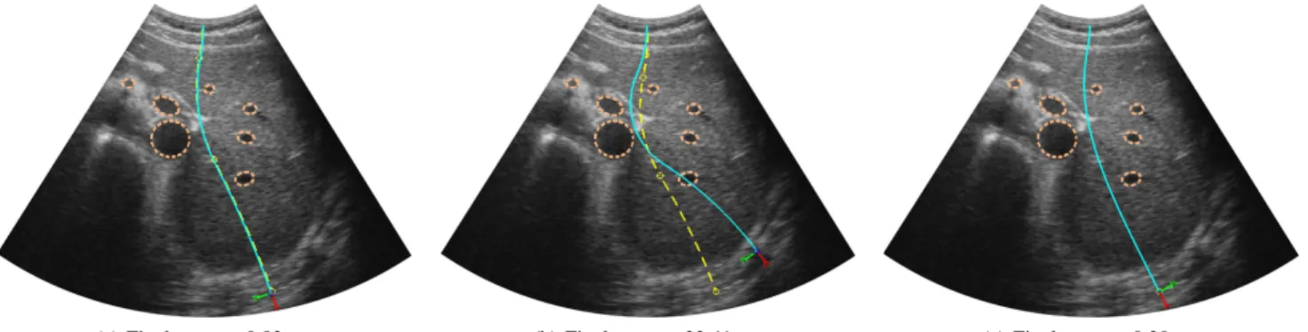 Fig. 5: Simulated trajectories of the needle tip in simulations of (a) an ideal situation, (b) under disturbances and (c) with adaptive replanning for noise compensation