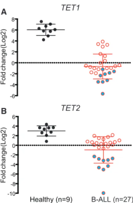 Figure 1. Analyses of TET1 and TET2 Gene Expression in Human Acute B-Lymphocytic Leukemia Patients