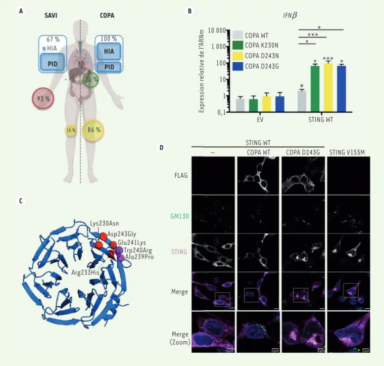 Figure 1. Les mutations de COPA sont responsables d’une induction chronique et pathogénique des interférons due à un défaut du trafic intra- intra-cellulaire de STING