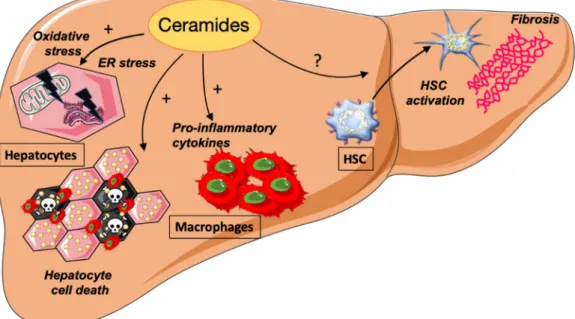 Figure 3. Actions of ceramides on non-alcoholic steatohepatitis (NASH) progression, HSC, hepatic stellate cells