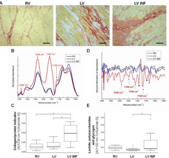 Figure 2. Immunohistochemical and FTIR analyses of fibrosis in human ventricle samples