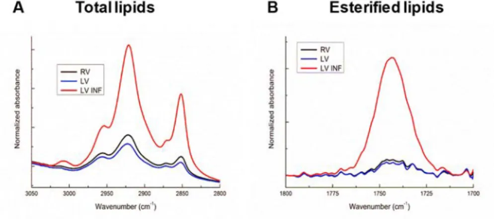 Figure 4. FTIR analysis of the total and esterified lipids in the human ventricle samples