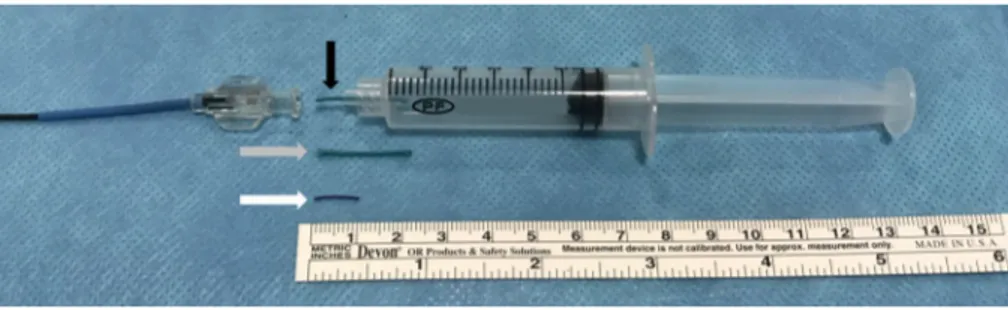 Fig. 1 Embolization fragment suture placed in a 5-mL syringe before release (Black arrow)