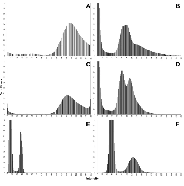 FIGURE 2 Whole images stack histograms from different sources: (A) X-ray 399 