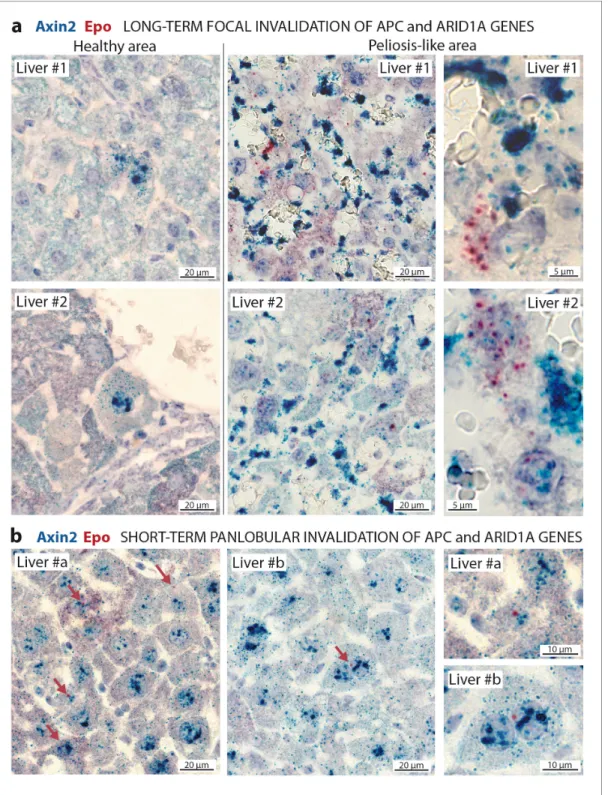 Figure 6. In situ hybridization of mRNAs showing a de novo expression of Epo in a subset of b-catenin-activated hepatocytes